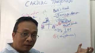 Cardiac Tamponade [upl. by Tayyebeb500]