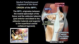 Medial Patellofemoral Ligament Of The Knee Anatomy Everything You Need To Know  Dr Nabil Ebraheim [upl. by Ytsirk]