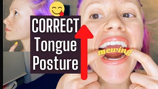 Mewing  How to Achieve Correct Tongue Posture Placement Back 13 Push on Palate [upl. by Ellasal493]