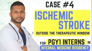 Acute Ischemic StrokeOutside Therapeutic Window for TPA  Internal Medicine Residency Series [upl. by Icyaj]