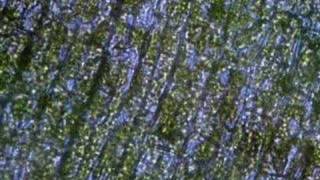 Plasmolysis in Elodea [upl. by Tteragram]