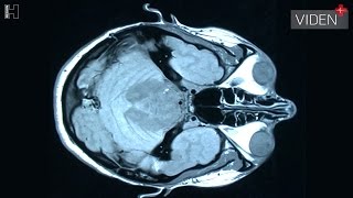 Mere præcise diagnoser med High Definition MRskanning [upl. by Reich121]