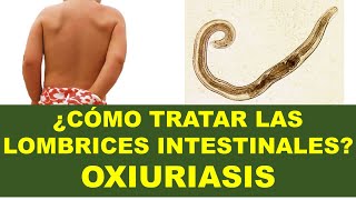 🔴 Lombrices intestinales que causan prurito perianal Oxiuriasis Síntomas Tratamiento y Prevención [upl. by Cuyler560]