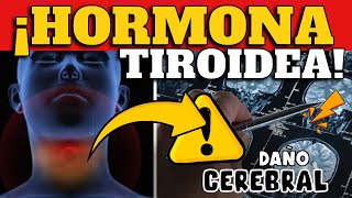 ¡CUIDADO EXCESO DE HORMONAS TIROIDES DAÑARÍAN AL CEREBRO [upl. by Ashman55]