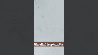 Microscopic identification of Giardia lamblia  cysts and trophozoite [upl. by Eentruoc]