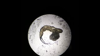 Enterobius vermicularis  Pin Worm  Thread worm  MedicoFem [upl. by Larue197]