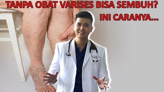 Cara Menghilangkan Varises Kaki Tanpa Obat [upl. by Onaled127]