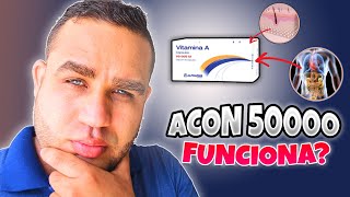 ACON 50000 VITAMINA A RETINOL PARA QUE SIRVE  DEBES SABER ESTO [upl. by Hsan]