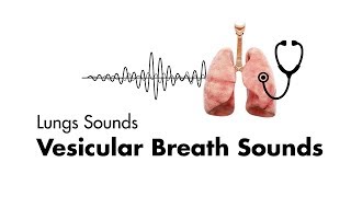 Vesicular Breath Sounds  Normal Lung Sounds  MEDZCOOL [upl. by Rancell]