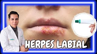 Así se puede contagiar el HERPES LABIAL  javierderma pielsana [upl. by Ayotahs]