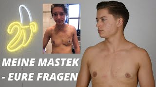 QampA  ich beantworte eure Fragen zu meiner MastektomieBrustoperation  FTM TRANSGENDER [upl. by Stanton288]