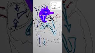 Tricuspid Atresia CHD Shorts [upl. by Arrais460]