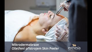 Mikrodermabraze  Ošetření přístrojem Skin Peeler [upl. by Anialam987]