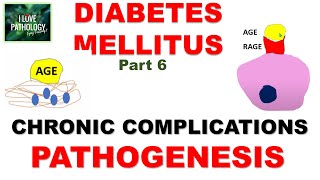 DIABETES MELLITUS  Part 6 Chronic Complications Pathogenesis [upl. by Ahselet585]