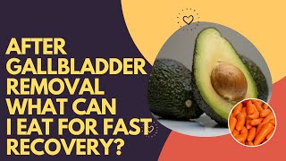 After Gallbladder Removal What Can I Eat For Fast Recovery [upl. by Sethrida]