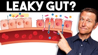 7 Signs of a Leaky Gut — Dr Berg [upl. by Imim730]