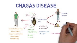 Chagas Disease  An overview [upl. by Yrffoeg]