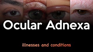 Ocular Adnexa Illnesses and Conditions [upl. by Daisie]