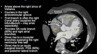 Coronary Arterial Anatomy [upl. by Nepsa181]