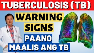 Tuberculosis TB Warnings Signs Paano Maalis ang TB  By Doc Willie Ong [upl. by Jarus]