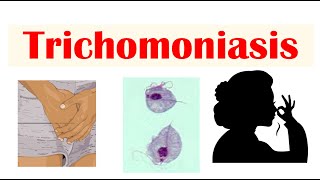 Trichomoniasis Common STI  Causes Symptoms amp Complications Cancer Diagnosis Treatment [upl. by Latnahs]