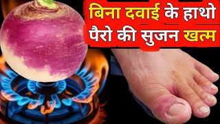 ठंड में उंगलियों की सूजन ऐसे करें दूर  Finger Swelling in Winter chilblains homeremedies [upl. by Chandos]