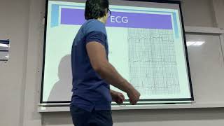 Med 1 Embolia Pulmonar [upl. by Fotinas]