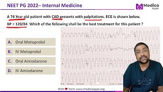 NEET PG Recall 2022 Sustained Monomorphic Ventricular Tachycardia Internal Medicine [upl. by Zasuwa642]