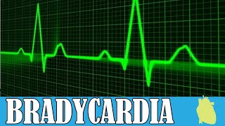 Bradycardia  Causes  Symptoms anaesthesia medicalstudent medical medicines [upl. by Flore]