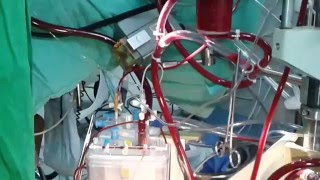 PERFUSION TECHNOLOGY IN SHORT VIDEO EXPLAINED [upl. by Reel164]