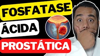 Fosfatase Ácida Prostática Alta no Exame de Sangue  Câncer de Próstata  Bioquímica Clínica [upl. by Mauldon462]