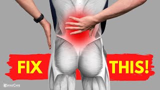 How to Fix Lower Back Strain Pain in 30 SECONDS [upl. by Truitt]