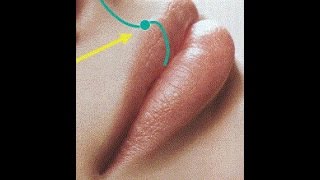 Different Types of Lip Injections [upl. by Carena]