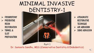 Minimal Invasive Dentistry Atraumatic restorative technique Tunnel amp Slot Preparation Fissurotomy [upl. by Duhl]