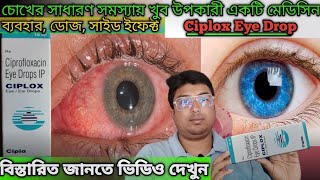 Ciplox Eye Drop  Ciplox Eye Drop Uses in Bengali  Ciprofloxacin Eye Drop Mode of Action [upl. by Rozella]