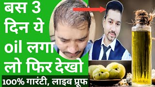 Best Hair Growth Herbal Oil For Male Female  Baal Ugane Ki Dawa  How To Regrow Hair [upl. by Glenna]