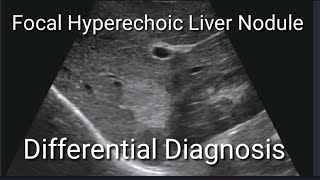 quotExploring Hyperechoic Liver Nodules Differential Diagnosis and Key Considerationsquot [upl. by Akinehc891]