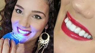 Affordable Effective Teeth Whitening  Smile Bright Review [upl. by Boothman]