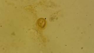 Fertilised decorticated egg of Ascaris lumbricoides [upl. by Shoshana]