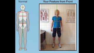 Postural Assessment Guide [upl. by Yevoc]