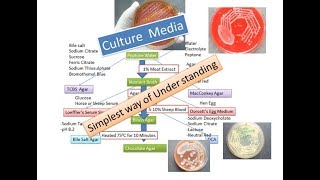 Culture media  The simplest way of understanding  for ever [upl. by Birkner231]