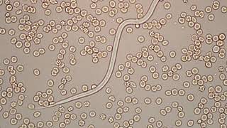 Dirofilaria immitis  microfilaria 400x [upl. by Enihpets860]