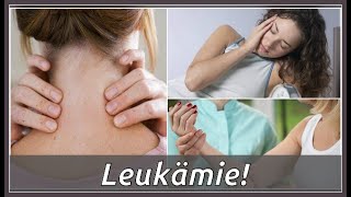 Das sind Symptome von Leukämie [upl. by Christiana851]