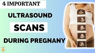 4 Important Scans During Pregnany  Ultrasound Scans During Pregnancy  Top 4 Scans during pregnancy [upl. by Shay]