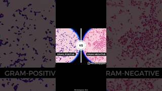 Gram stain  Gram stain procedure manual  medical shortvideo viralvideo microbiology mbbs [upl. by Milon]