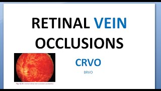 Ophthalmology CRVO Central Retinal Vein Occlusion Splashed tomato Thunder Ischemic RAPD glaucoma [upl. by Lledal]