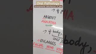 Developmental disturbances of jaws  Oral Pathology  Shafers chapter 1 shortvideo shorts [upl. by Raney]