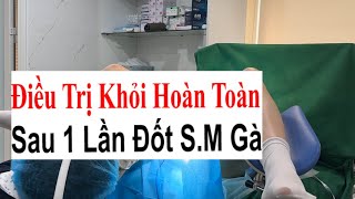 Chia Sẻ Quá Trình Đốt Sùi Mào Gà Duy Nhất 1 Lần Đã Khỏi Bệnh Hoàn Toàn Tại Bs Sắc [upl. by Oznola]