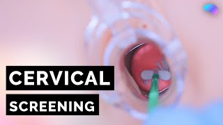 Cervical Screening Smear  HPV  OSCE Guide  UKMLA  CPSA [upl. by Ennywg]