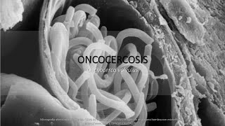 Oncocercosis BIOLOGÍA resumen  memorización [upl. by Artim]